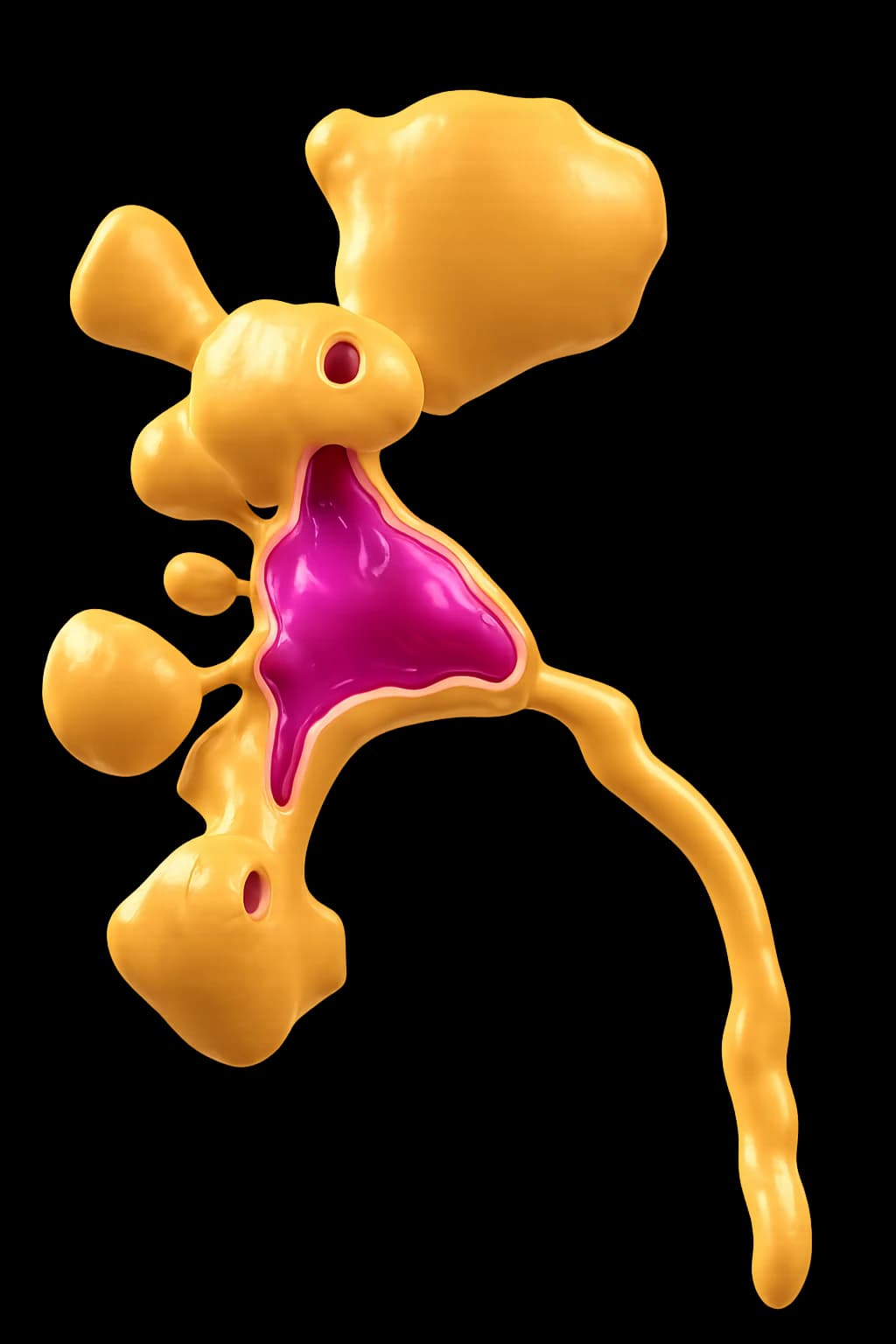 Stone Burden and Density: Mapping Kidney Stones in 3D for Endourological Planning